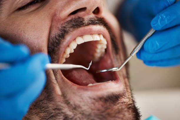 Professional Emergency Dental Service in MD